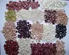 Large White Kidney Bean Wholesales Price