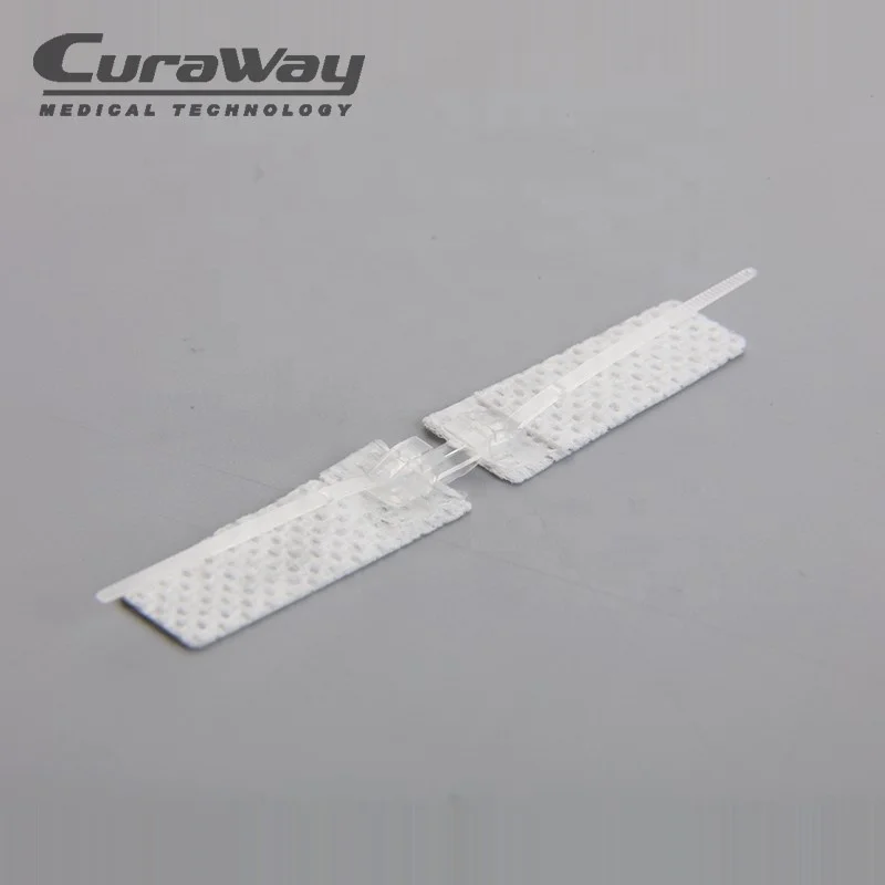 
Disposable Medical Supply Surgical Adhesive Wound Dressing Wound Skin Closure 