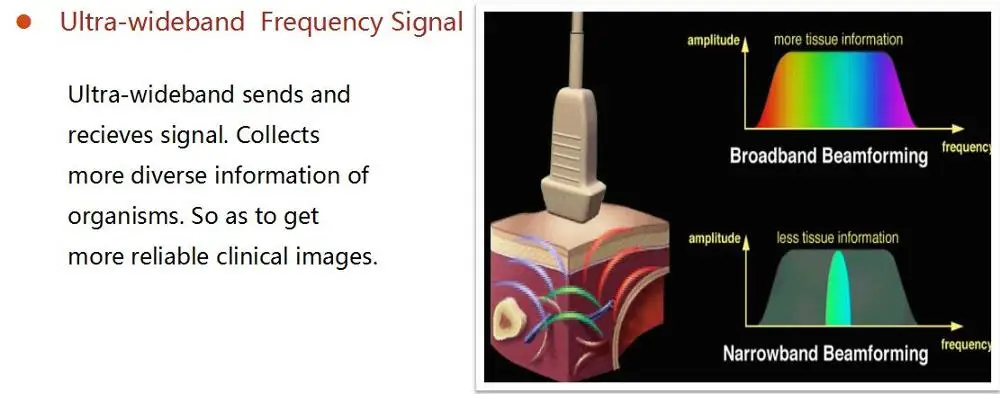 Ultrasonic USG ultrasound Scanner portable ultrasound usg