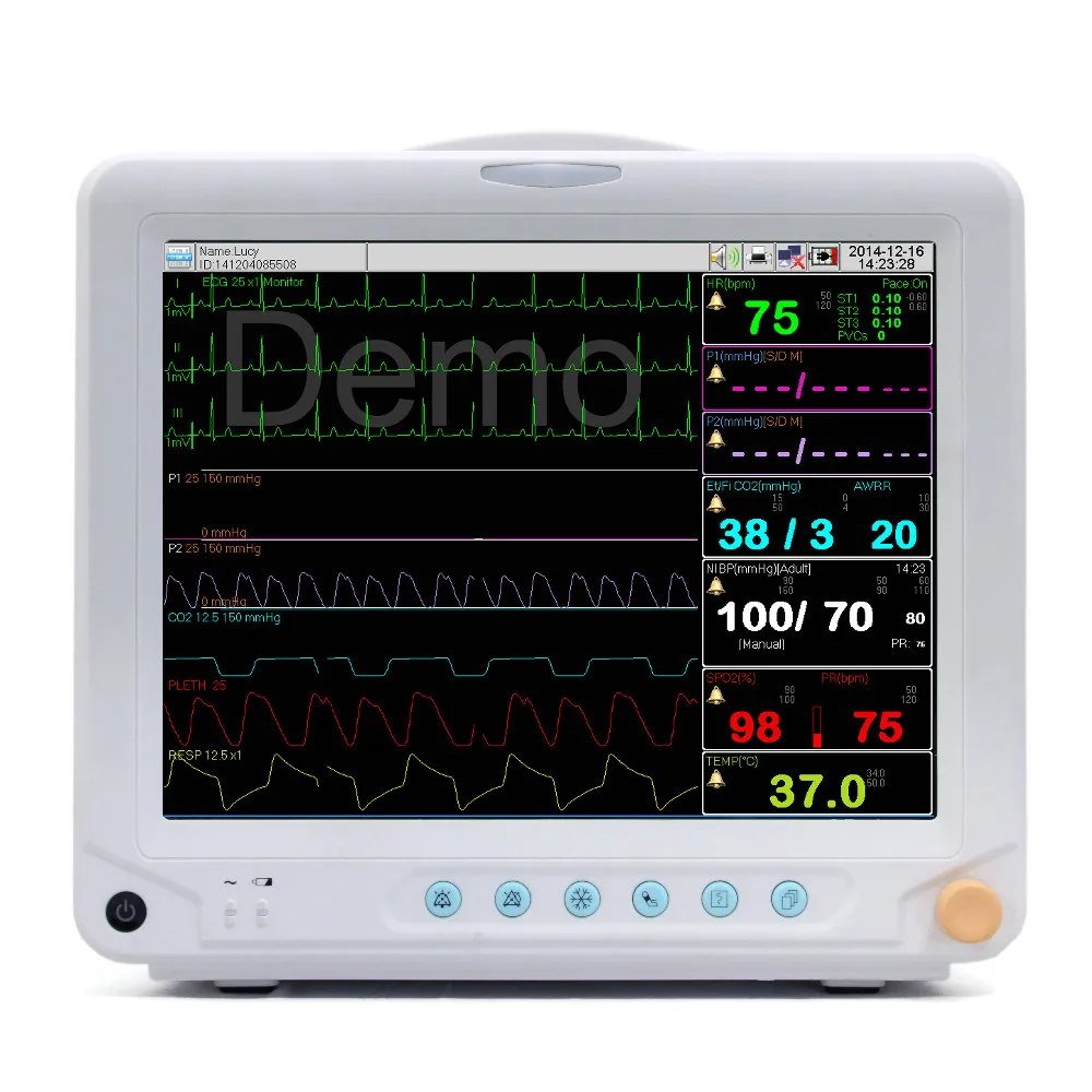 Монитор температуры. Монитор прикроватный с функцией капнографии. Moni 2b/2bv монитор пациента. Монитор пациента с блоком капнографии. Больничный монитор.
