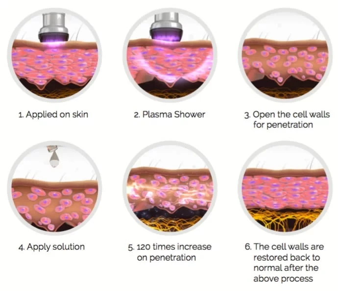 GOMECY Medical Plasma shower handle surginal or needle handle machine skin rejuvenation for antibacterial antivirus.jpg