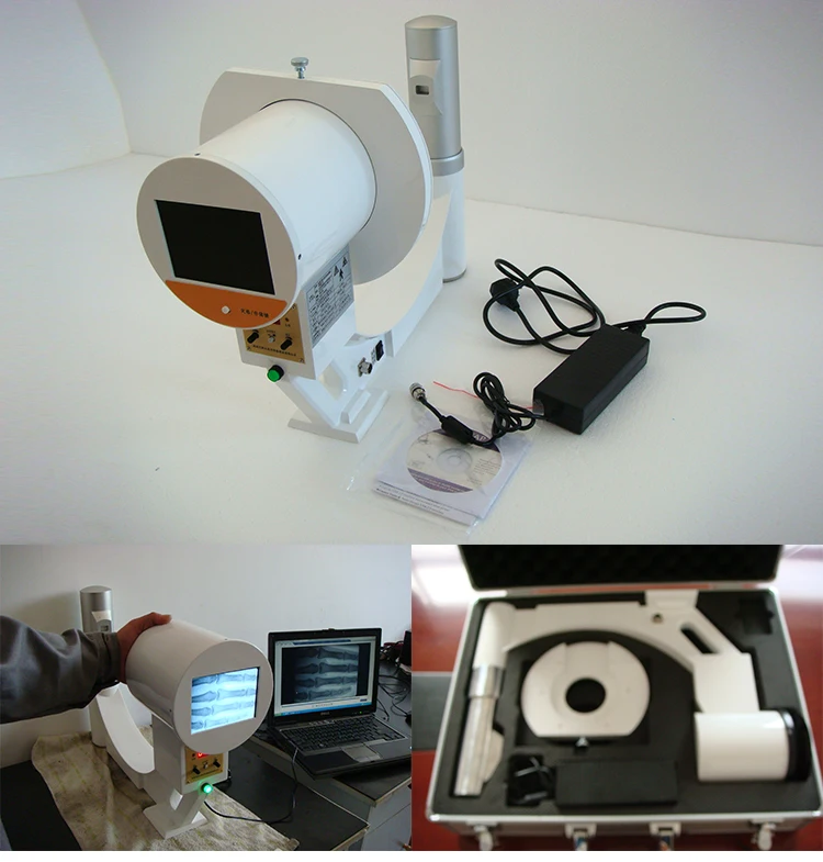 Hospital Instrument Myd001b Medical Fluoroscopy Portable Xray