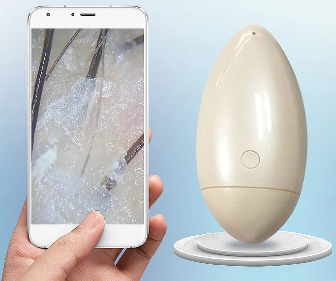 

Wireless Hair Analyzer/ Scalp Problem Checker, White
