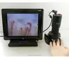DMX980 Microscope microcirculation Microvascular capillary microscope digital microscope camera