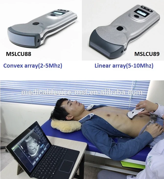 High Frequency 10mhz Linear Array Wifi Ultrasound,Multifrequency 5