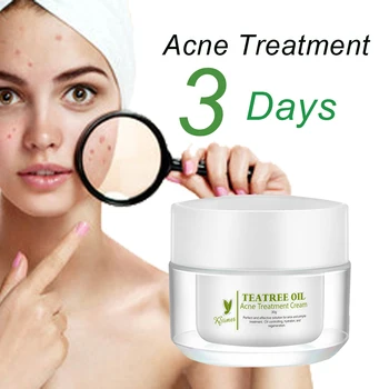 Wholesale Alibaba Pimple Acne Treatment For Oily Skin Acne ...