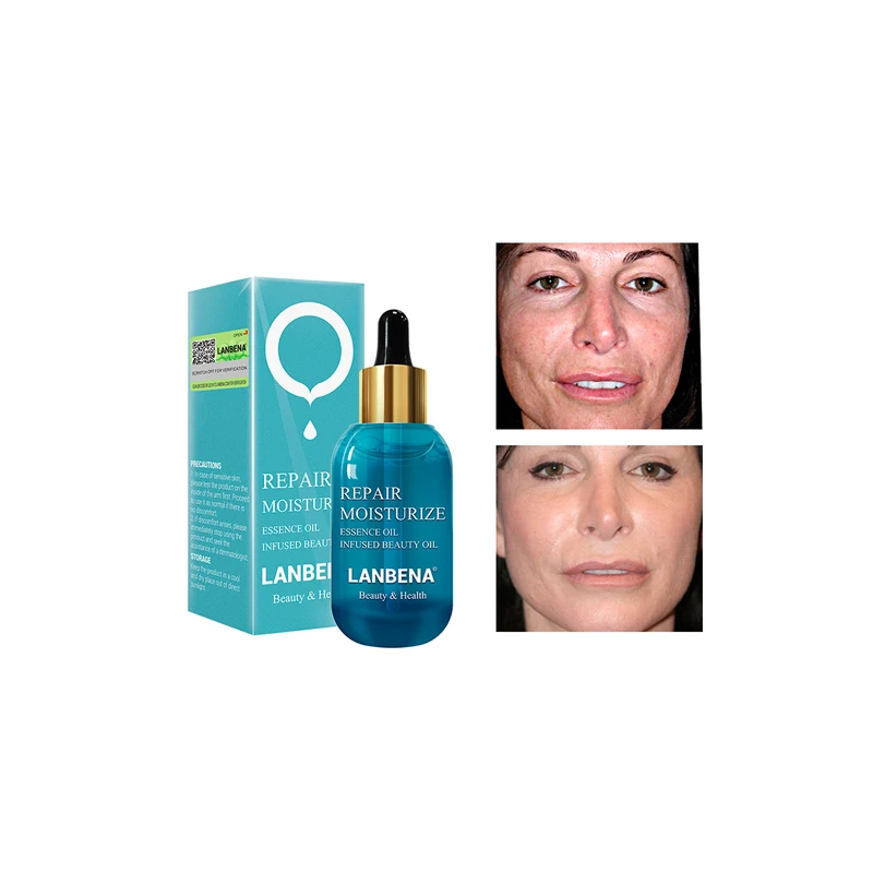 

LANBENA oil free face moisturizer hyaluronic acid essence oil serum free shipping