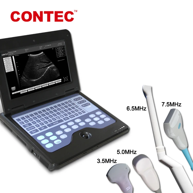 
Real manufacturer CONTEC CMS600P2 portable b ultrasound machine 
