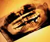 china wholesale dental x-ray film scanner, industrial x-ray film viewer, x-ray film developer and fixer