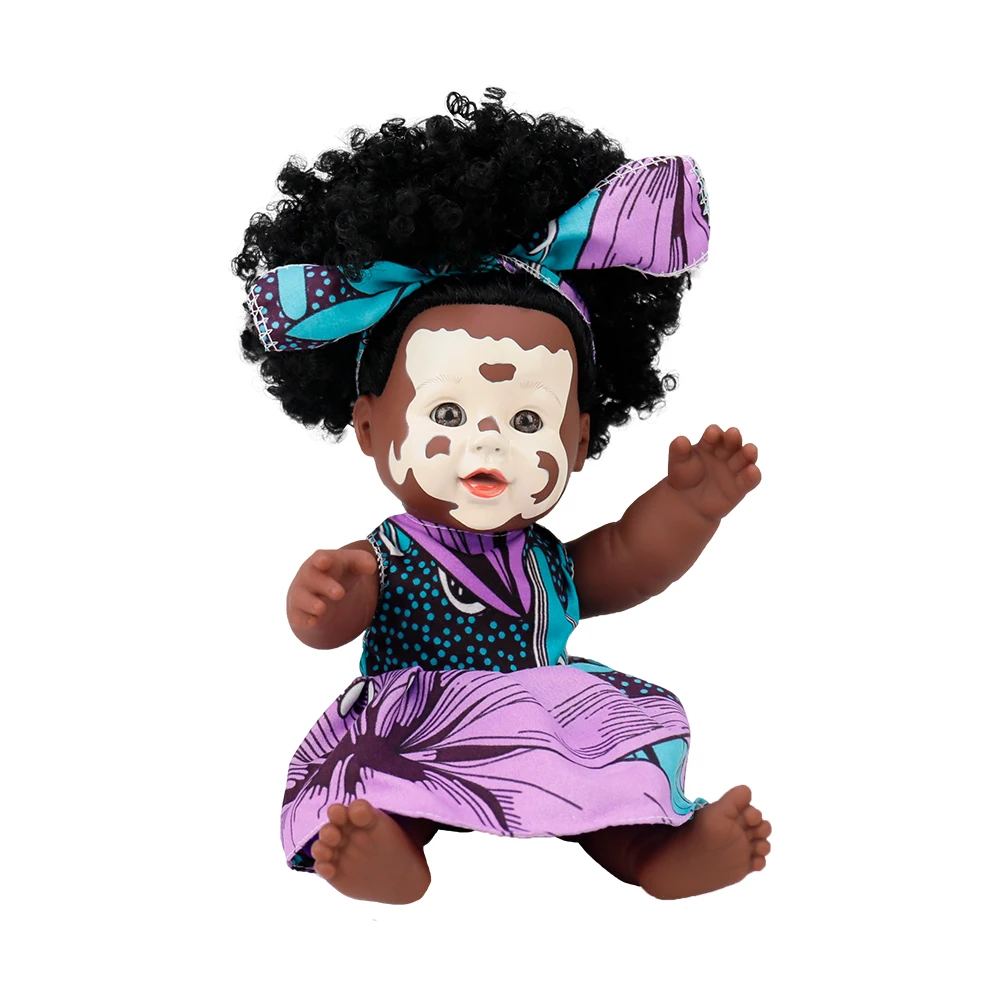 2019 Wholesale Vinyl Vitiligo Doll 12 Inch Lifelike African American