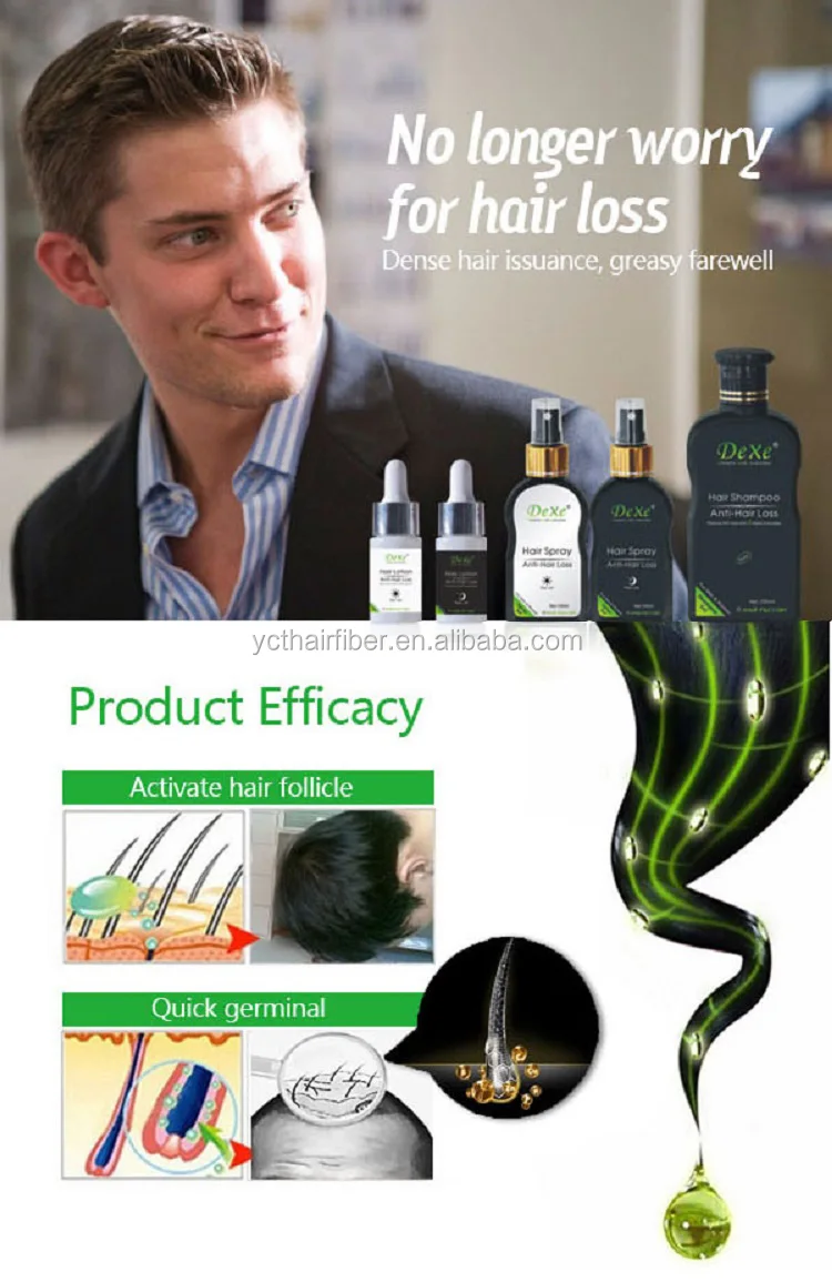 Chinese Herb Formula Anti hair Loss Hair Growth Shampoo Private Label