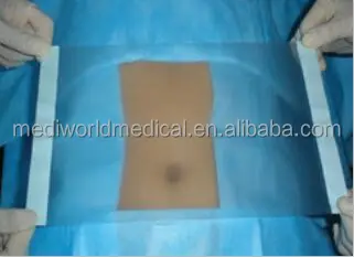 
CE NPWT medical hemostatic drainage sponge 