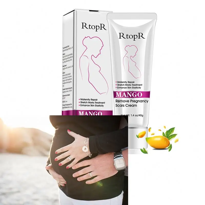 

organic pregnancy stretch mark removal creams for anti marks