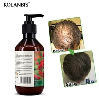 

Hair Loss Product Organic Woman Man Anti Hair Loss Shampoo Repair Follicle Thick Fast Hair Growth Treatment
