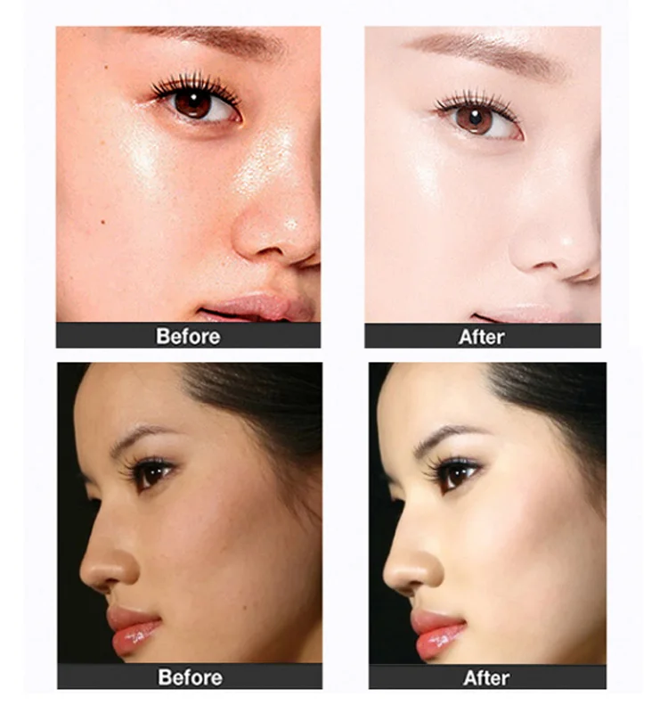 best instant whitening cream