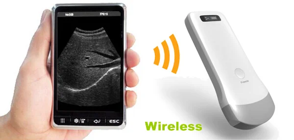High quality MY-A010B portable type handheld wireless ultrasound convex probe price for smartphone/iphone/ipad