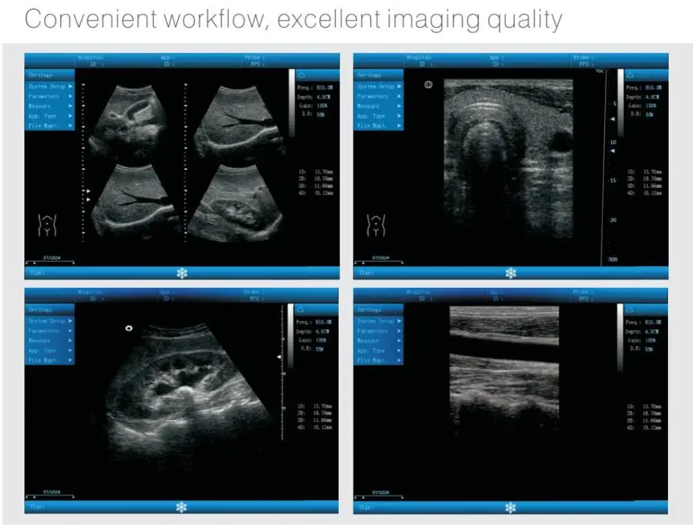 Black white Ultrasound Machine Cheap Ultrasound Machine B ultrasound Machine