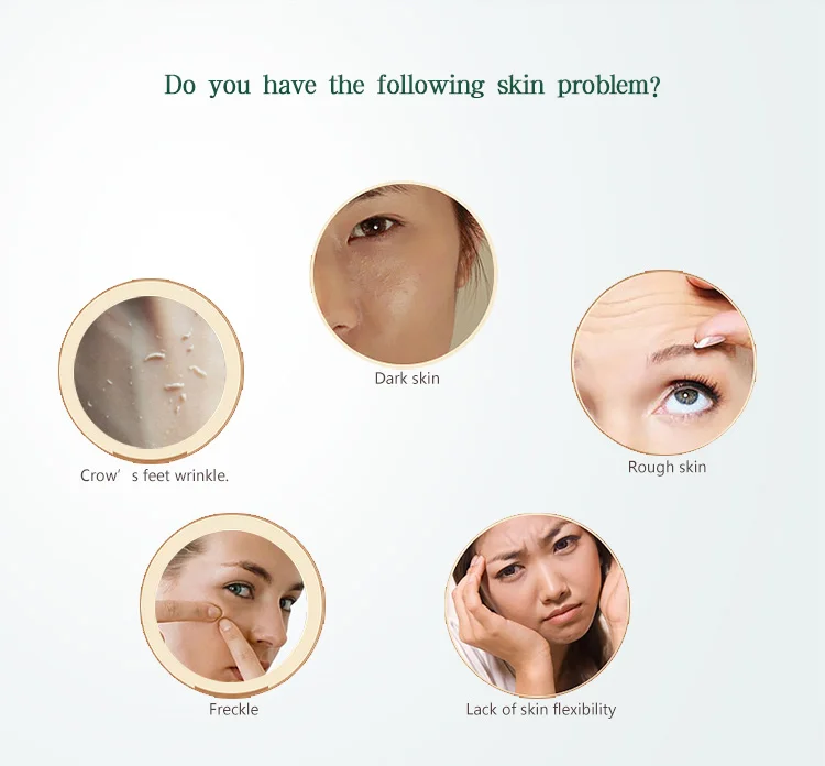 Korea Popular Vacuum Facial Pore Cleaner Blackhead Remover Suction  02.jpg