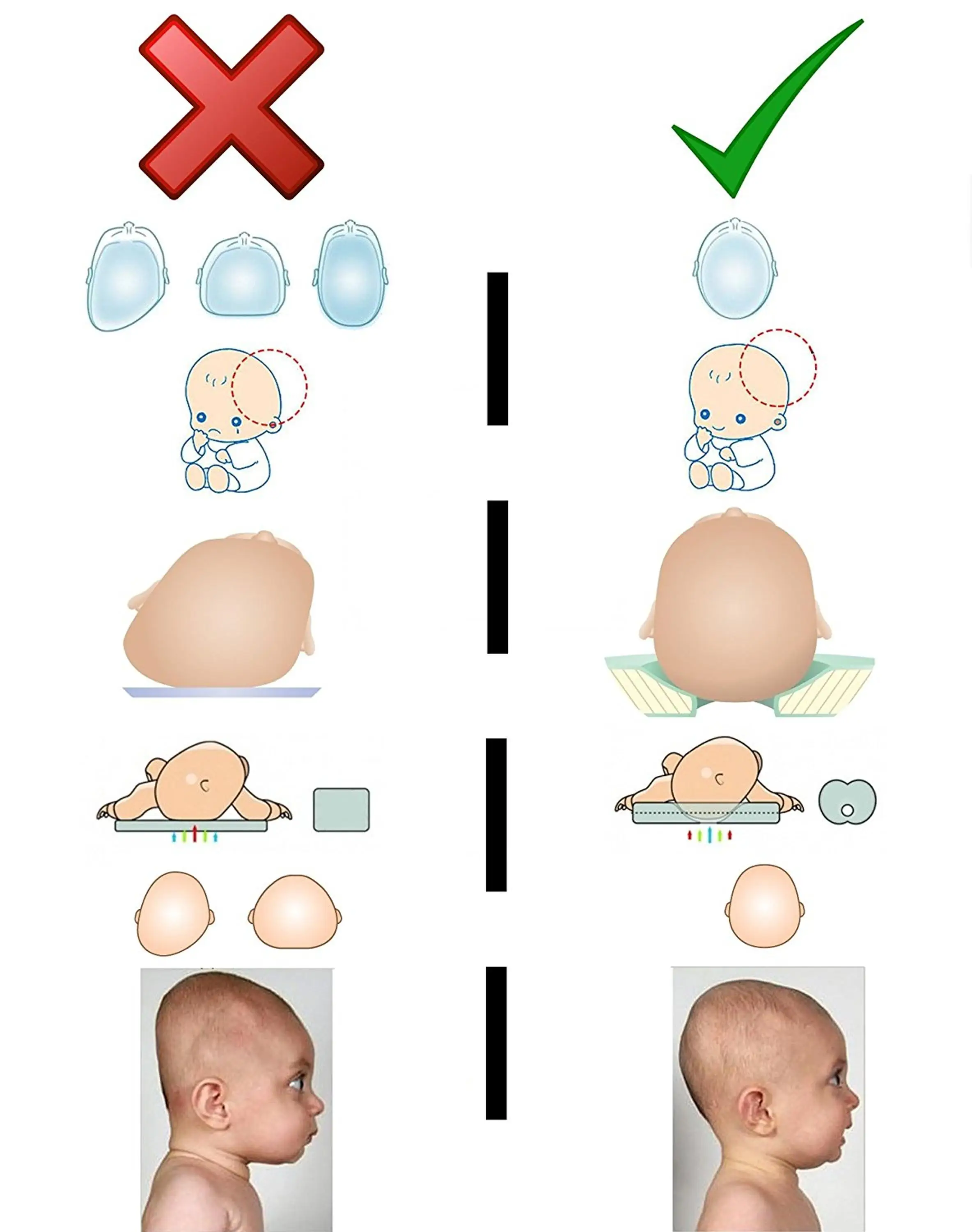 Babykissen zum Schlafen Kopfformendes Kopfkissen Verhindern Flat Head Syndrom Memory Foam Neugeborenen Kissen Geeignet f/ür 0-2 Jahre