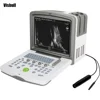 VS-WED-5100 Portable cheap price Ophthalmic Ultrasound A/B Scan Medical machine for biometry eye test in ophthalmology