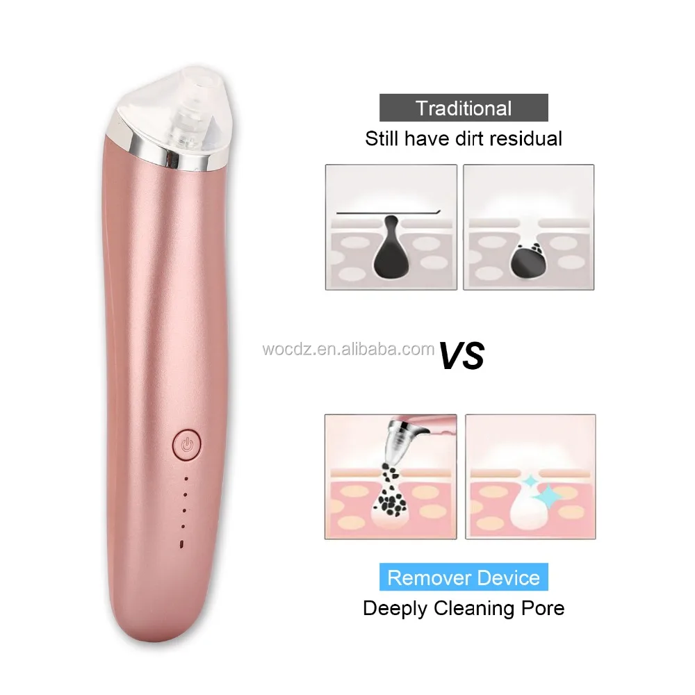 

The Most Effective Blackhead Vacuum Acne Cleaner Pore Remover Electric Skin Facial Cleanser Care Pore Cleaner, White / rose golden