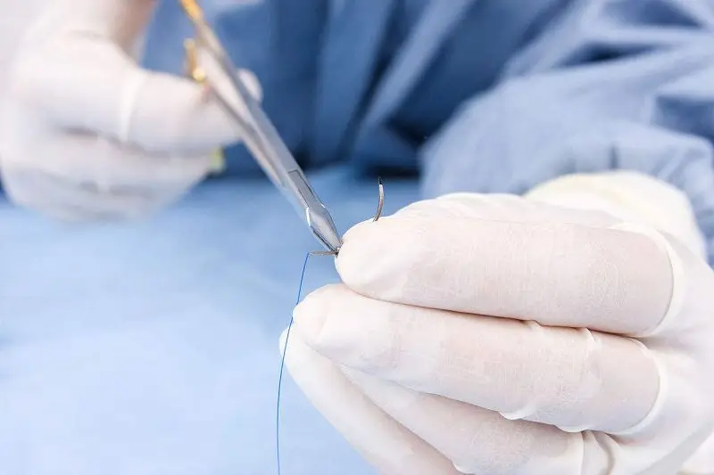 
High Quality Stainless Steel Medical Sterile Surgical Suture Needle with Low Price 