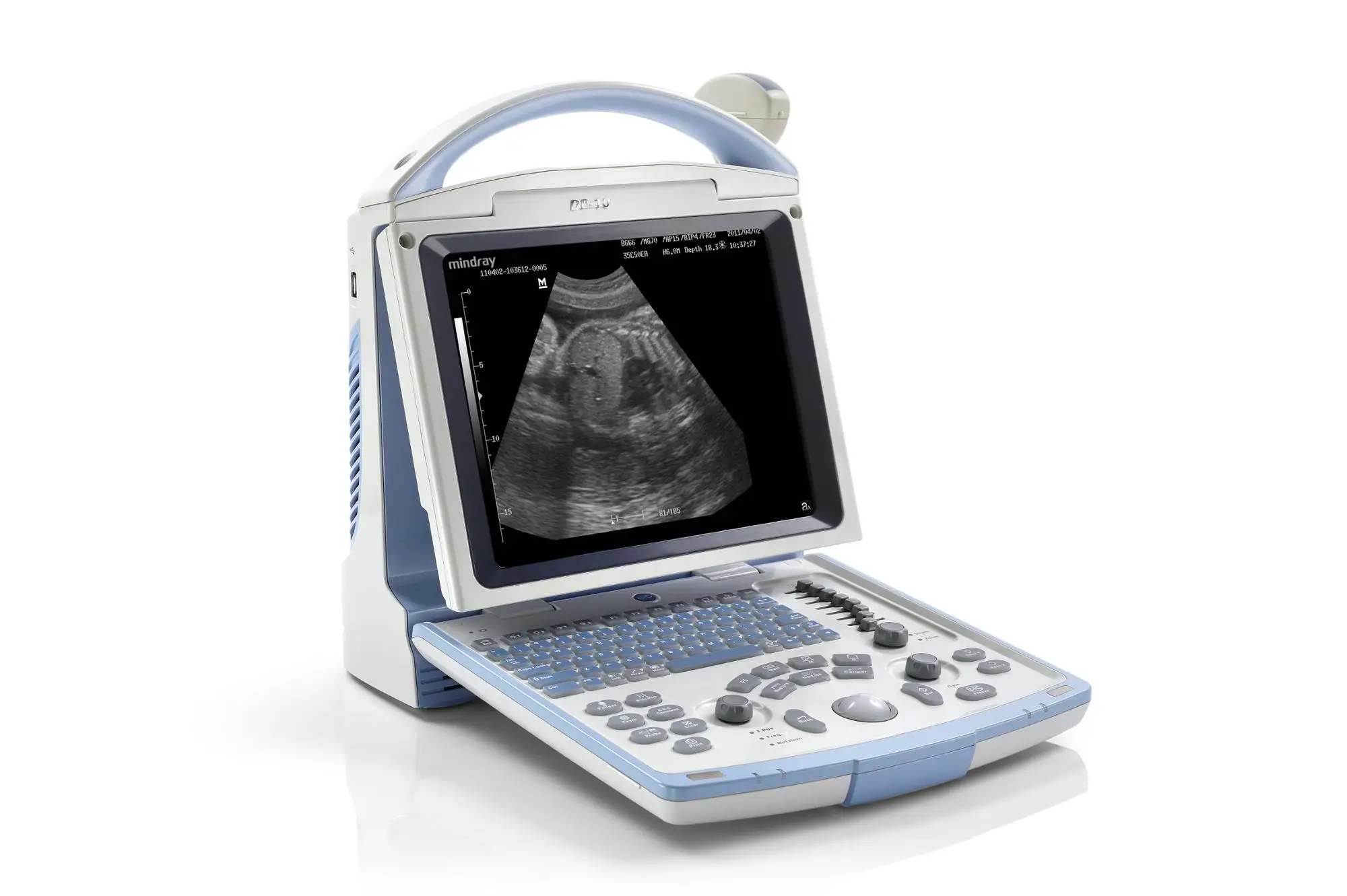 Mindray Dp-10 Ultrasound Machine China For Pregnancy/ultrasound ...