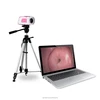 SW-3301 Portable Digital Video Colposcope / Laptop Colposope Introduction/ Vaginal Colposcopr