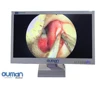 Surgical instruments set medical LED monitor