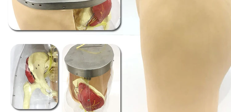 6 Injection model.jpg