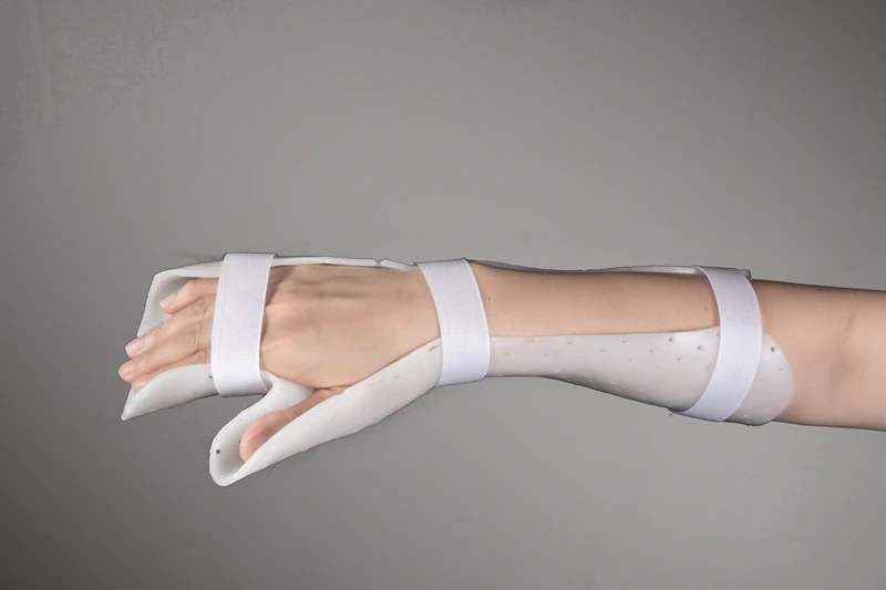 volar hand splint