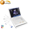 3D image high quality performance doppler ultrasound machine
