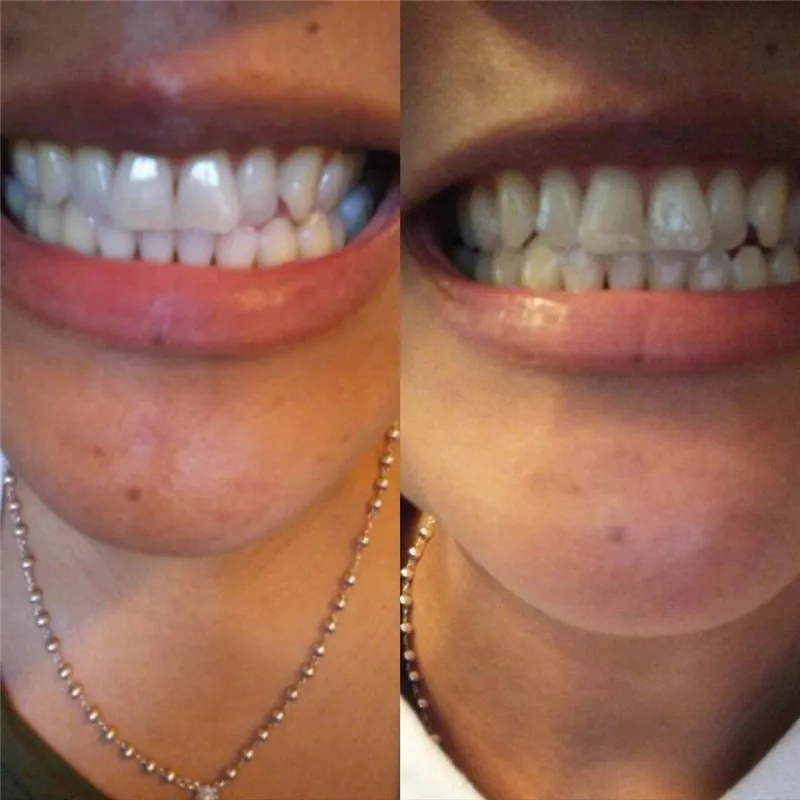 
Private Label Wholesale Activated Charcoal Teeth Whitening Toothpaste 