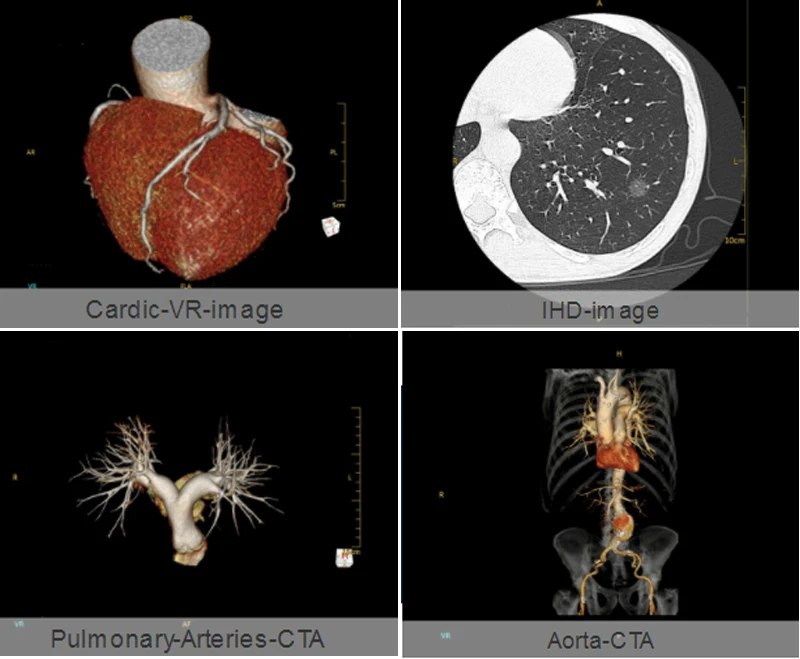medical ct scanner
