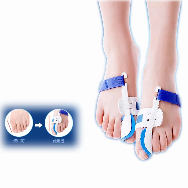 

Medicus Fixture Bunion hallux valgus night splint Hallux Valgus Corrector bunion Toe Separator, Blue, can be customized