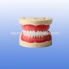 Soft gum standard 32 tooth model I