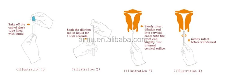 cervical dilator- instruction for use.jpg