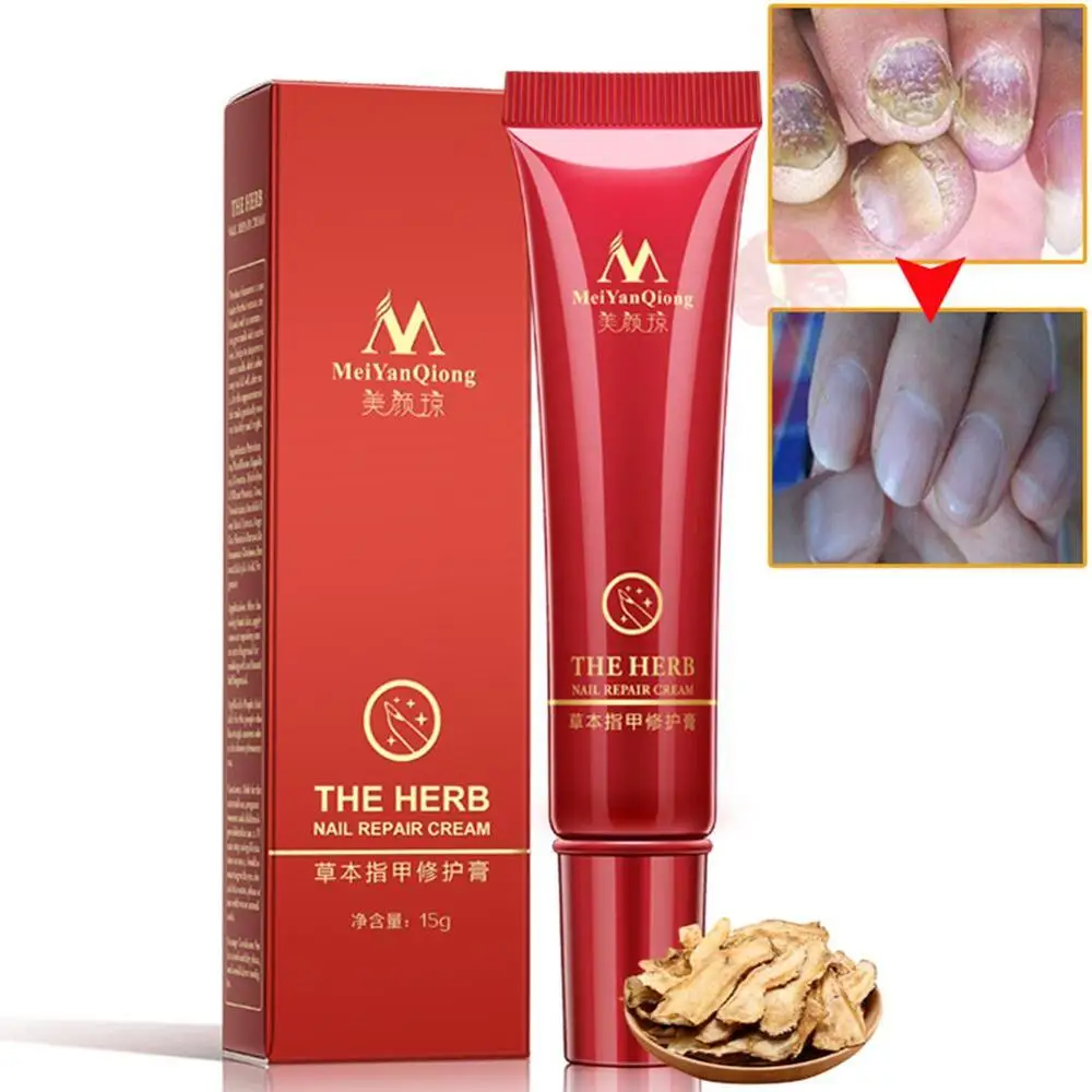 

Foot Nail Protector Skin Care Cream Nail Fungus Treatment Herb Nail Repair Cream
