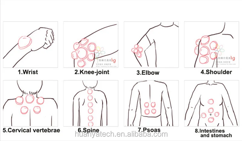 silicone cupping  (9).jpg