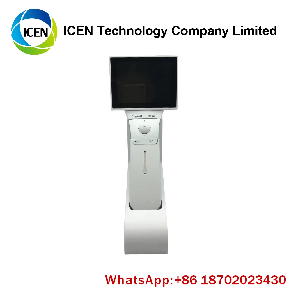 handheld fundus camera
