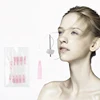 uni-l\/uni-s mono thread improves contour without the anchoring method