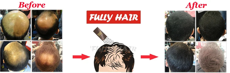 Кератиновые Волокна Для Волос Купить