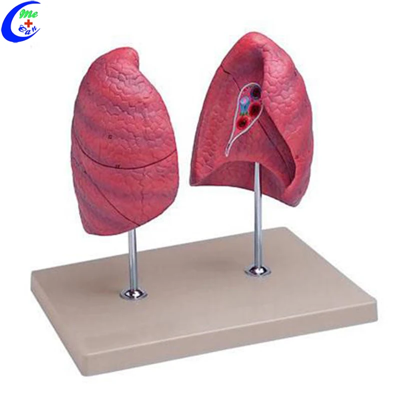 lung anatomic model.jpg