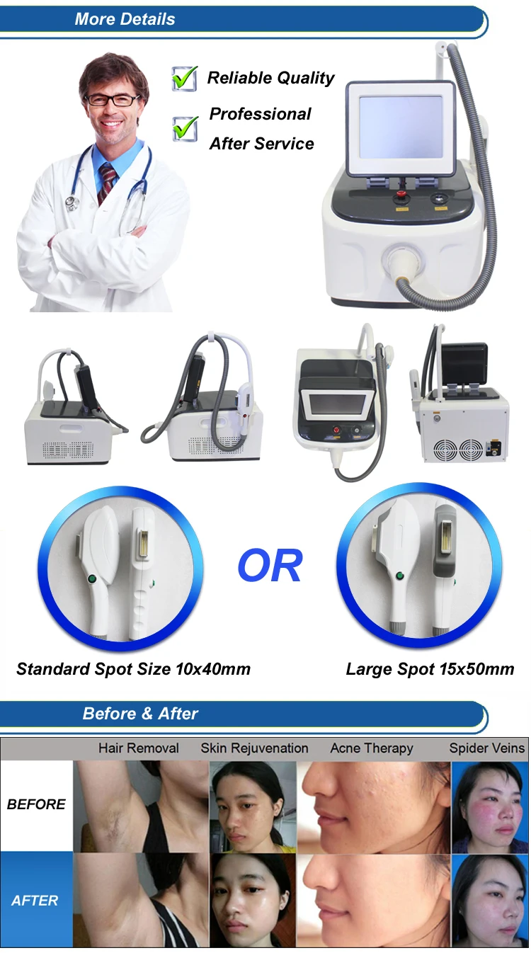 elight& shr for fast hair/ pigmentation/wrinkle removal