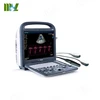 Summer Sale!! China SonoScape Color Doppler 2D/3D/4D Ultrasound Transducer / High Performance Portable S2 Convex Probe