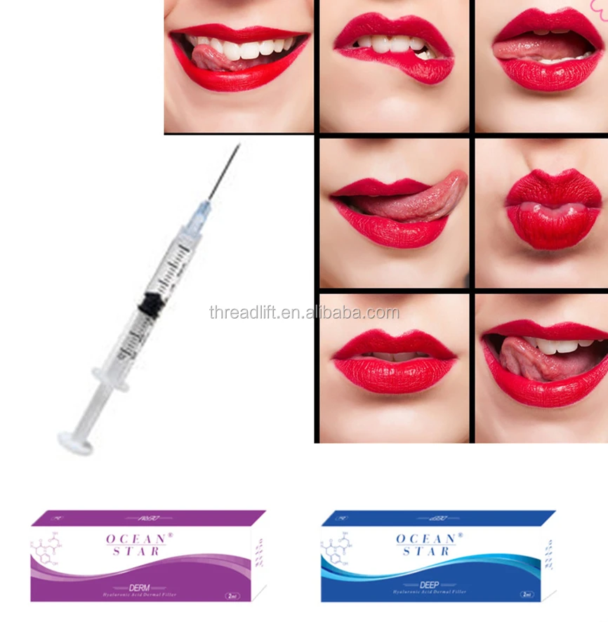 

Hot selling hyaluronic acid for lip injection 2 ml Derm, N/a