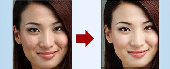 skin peeling machine.png