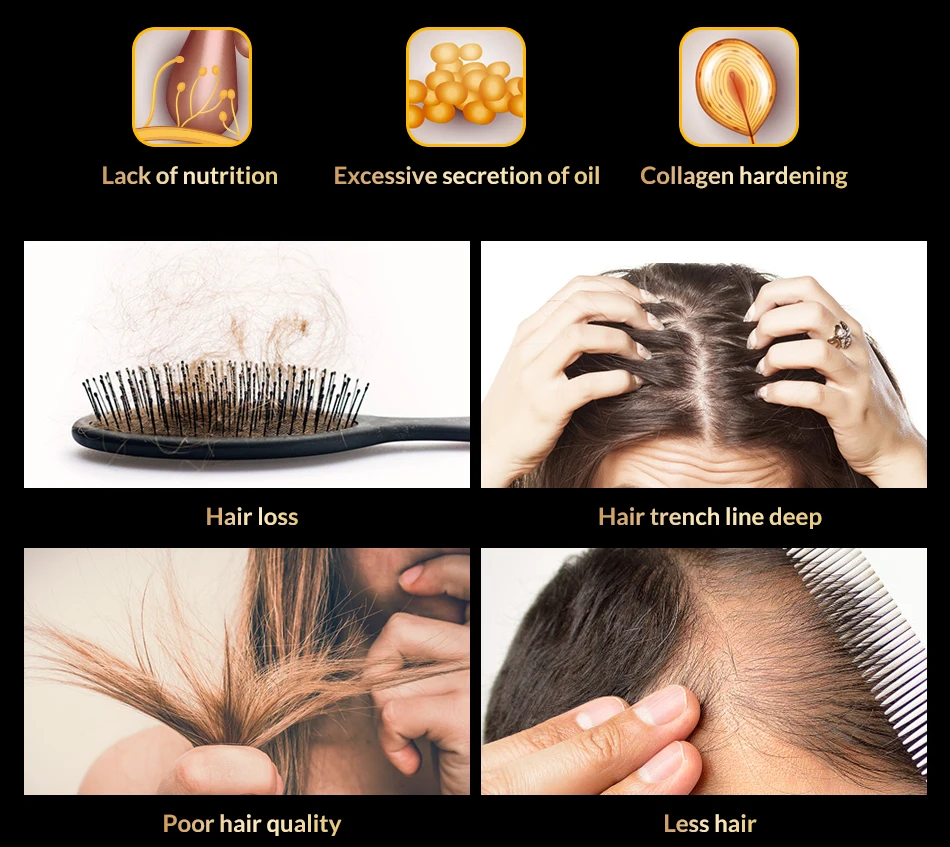 Sample Omy Lady 10 Ml Beauty Hair Treatment Nourish Roots Hair Care Anti  Loss Product For Man Woman - Buy Mens Hair Products,Hair Products For  Natural Hair,Wholesale Darling Hair Braid Products Kenya