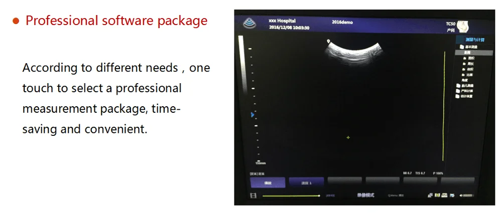 MT Medical Veterinary Ultrasound Machine