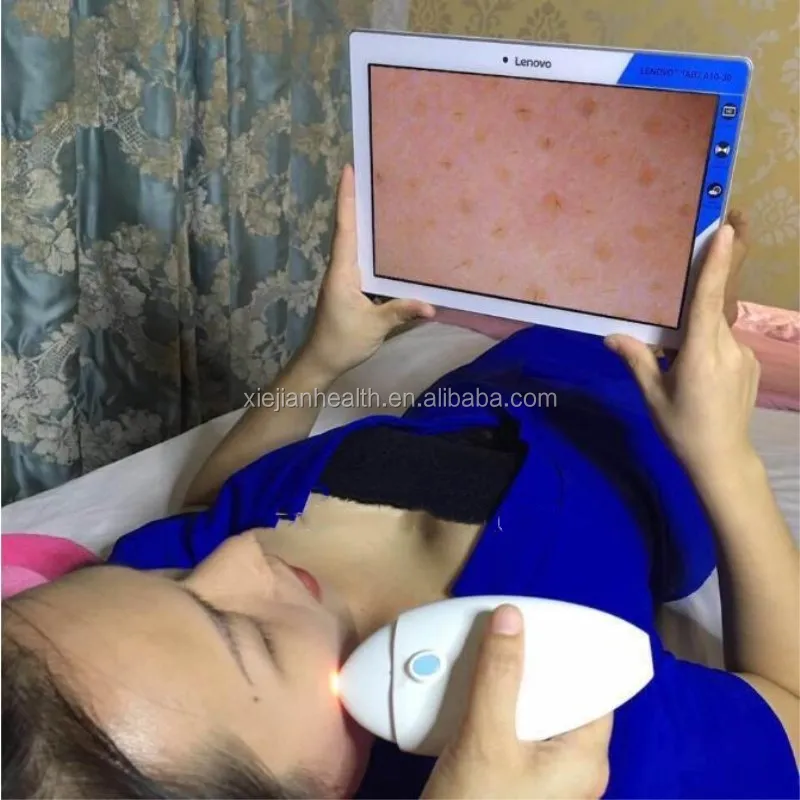new product of Water drop type WI-FI skin analyzer & scalp analyzer